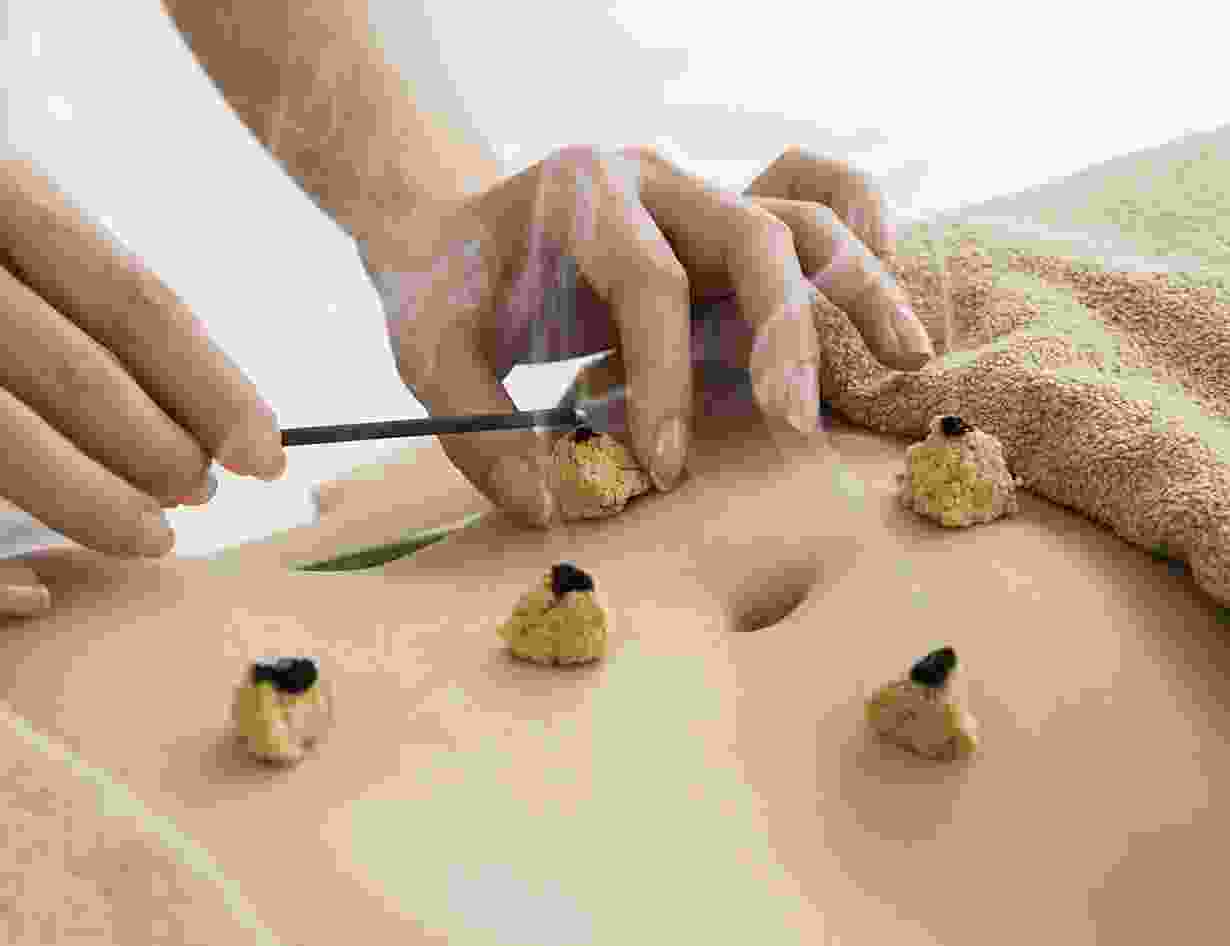 Chinese Moxibustion